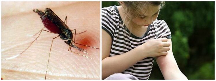 Boleče grudice po piku komarja so lahko simptom srčne gliste