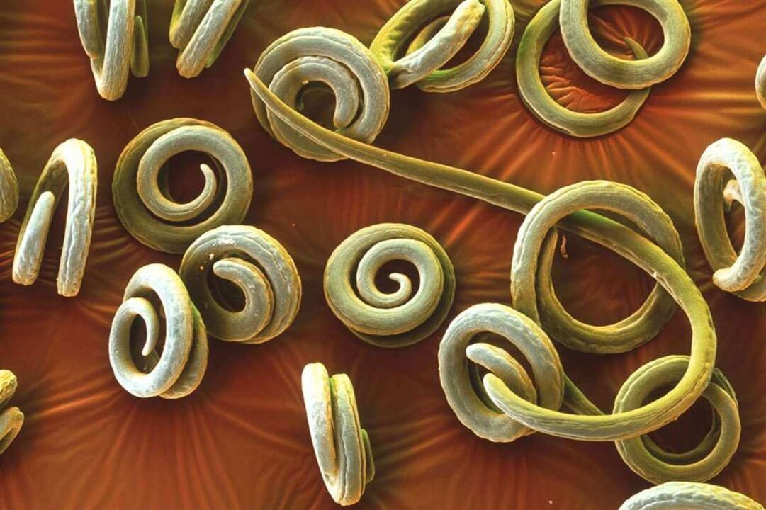 črvi paraziti iz človeškega telesa