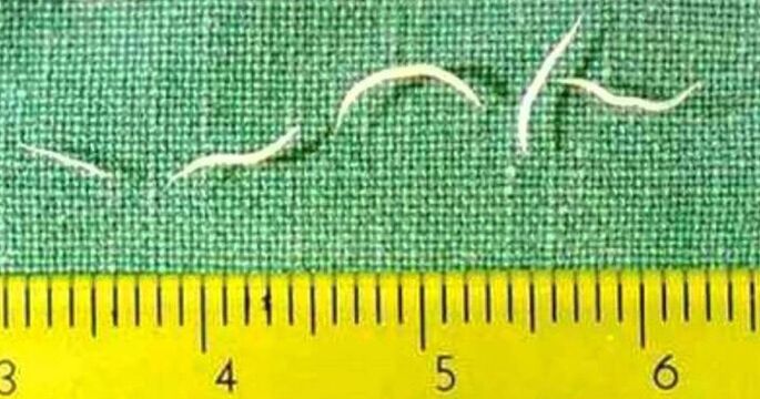 Pinworms so najpogostejša vrsta črvov pri majhnih otrocih. 