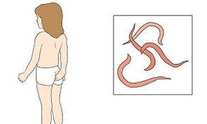 simptomi prisotnosti parazitov v človeškem telesu
