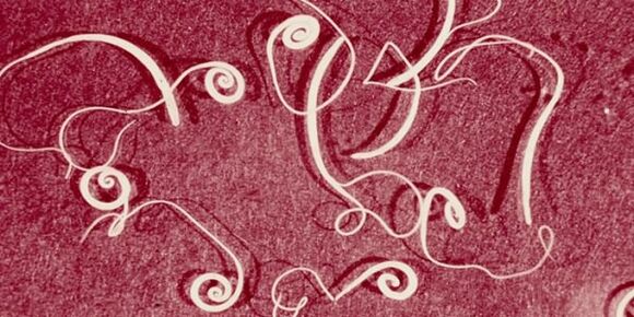 fotografija človeških parazitov