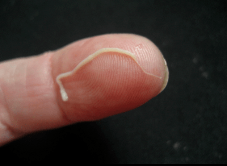 parazit okroglih črvov iz človeškega telesa