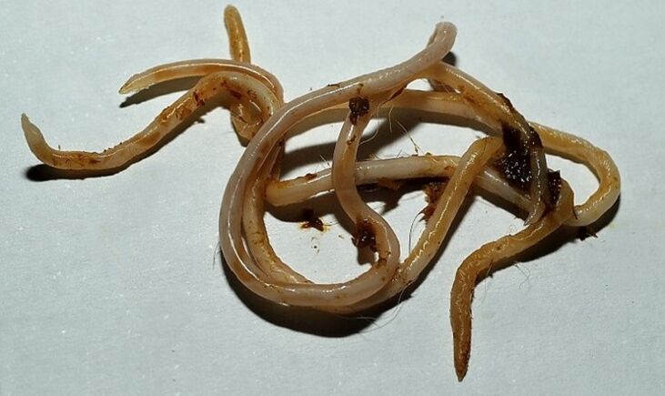 toksokar iz človeškega telesa